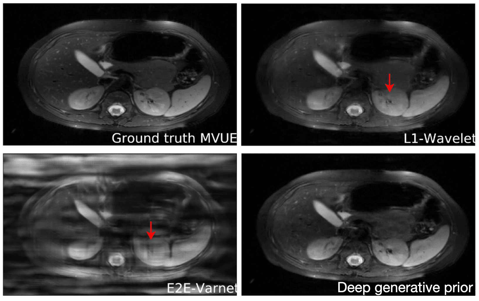 Deep generative priors results